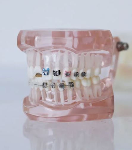 Orthodontic